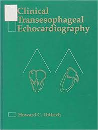 Clinical Transesophageal Echocardiography